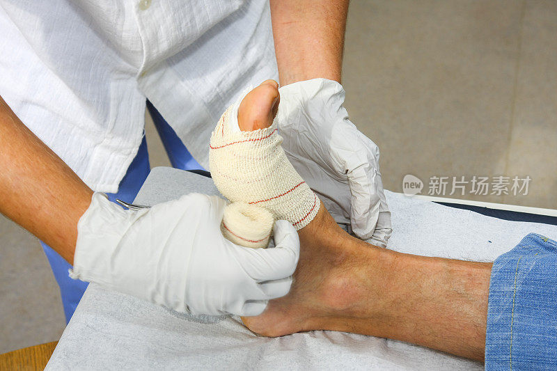 护士正在给一个受伤病人的脚换绷带