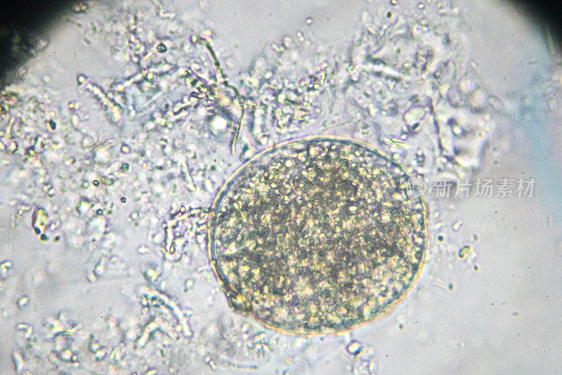 光镜下支气管吸虫卵