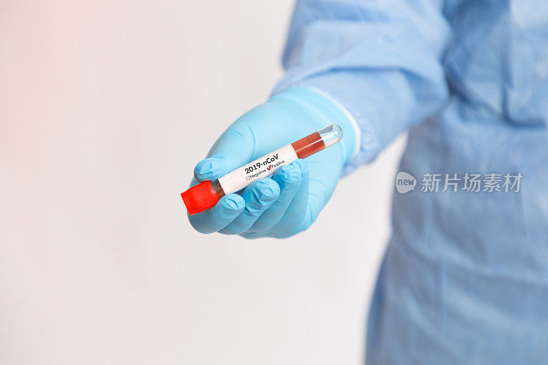 医生在白色背景的试管中拿着阳性冠状病毒样本