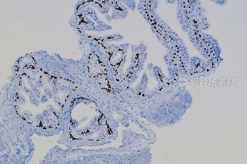 正常前列腺细胞的显微镜图像。
