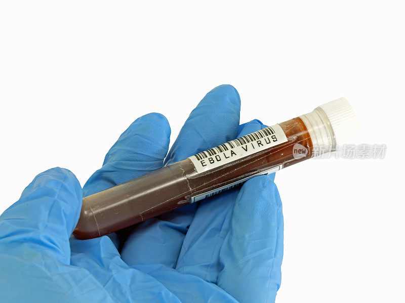 在无菌区域进行实验室分析时携带埃博拉病毒血液的试管