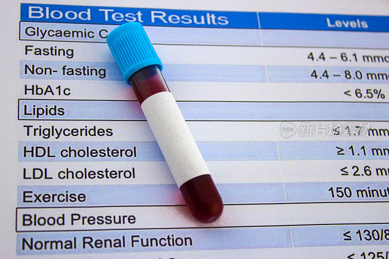 胆固醇测试和血液试管