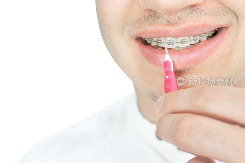 近距离的英俊的年轻人微笑着用漂亮的直白牙齿和牙套清洁牙齿，用牙间刷隔离在白色的背景上，直白的牙齿和牙套