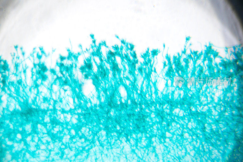 青霉菌在显微镜