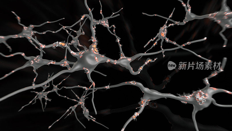 ALS损伤神经元细胞