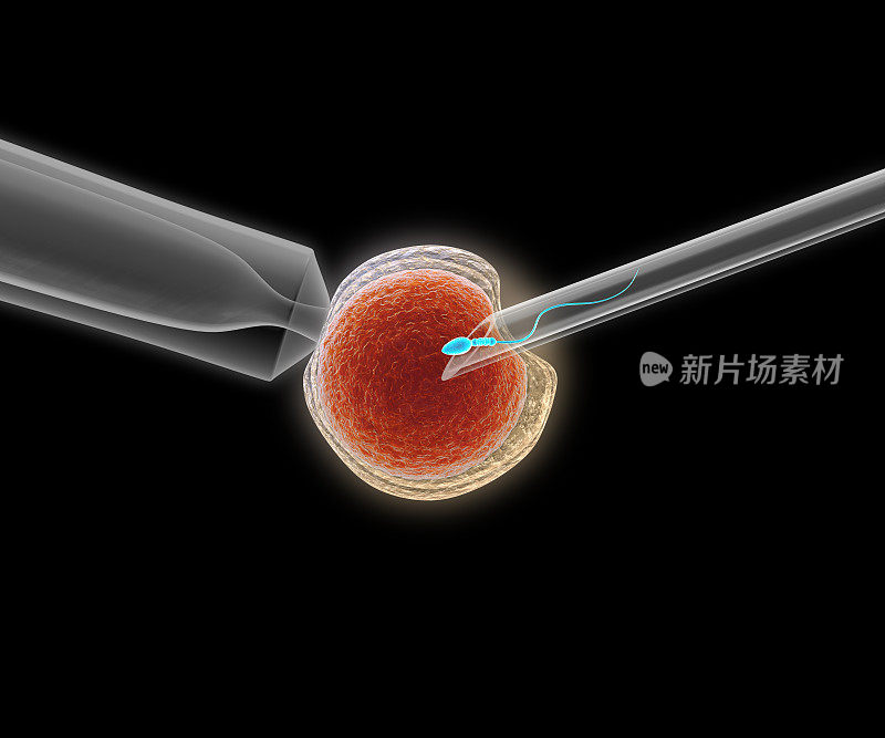 icsi(胞浆内精子注射)过程的3D插图——将单个精子直接注射到卵子中
