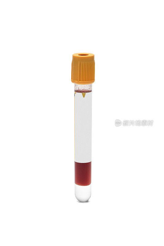 医用试管，血液样本