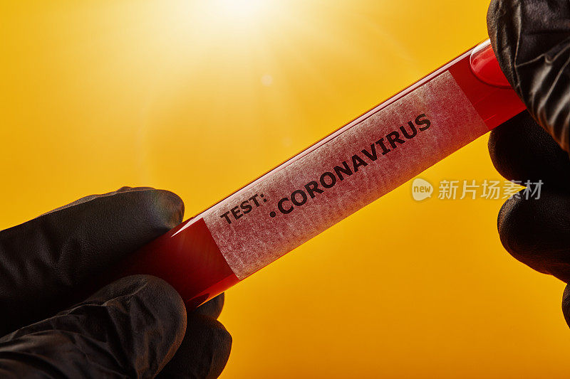 COVID-19血液样本准备好进行冠状病毒检测