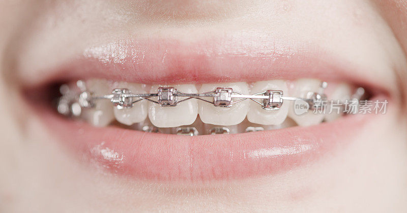 准备好迎接一生的微笑