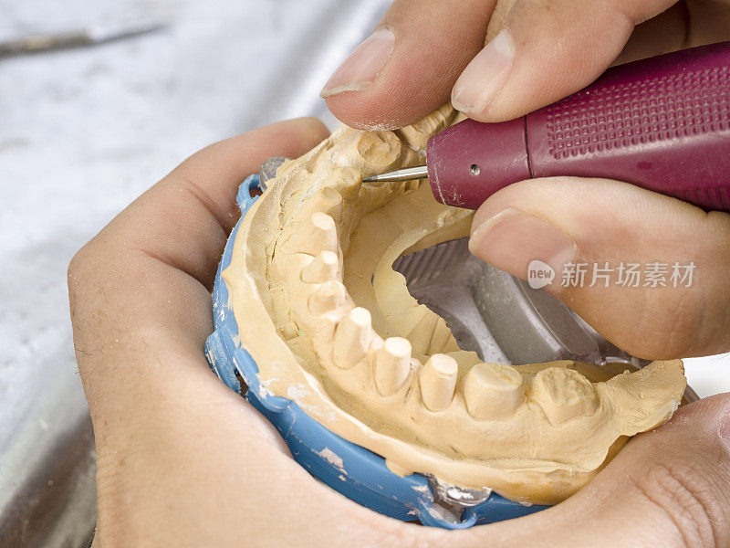 牙科技师用钻头模拟种植陶瓷牙