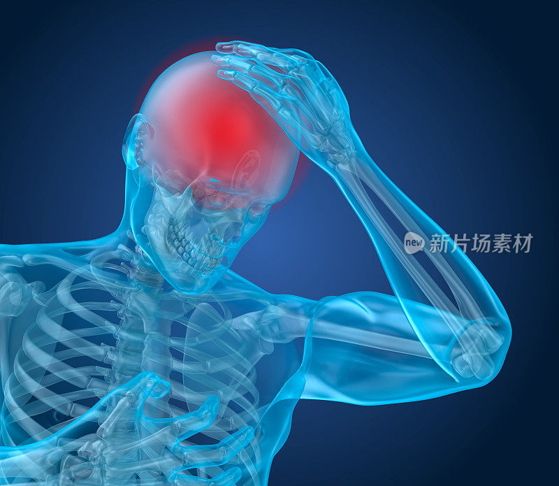 头痛发作，男人遭受脑部疼痛。三维演示