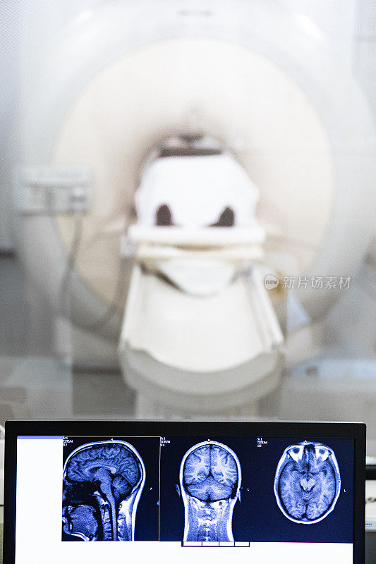 磁共振头部扫描图像在电脑显示器扫描