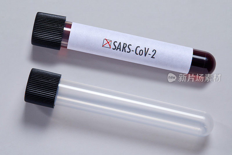 血液样本SARS-CoV-2
