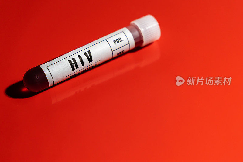 HIV艾滋病病毒血液样本试管特写白色标签，红色背景