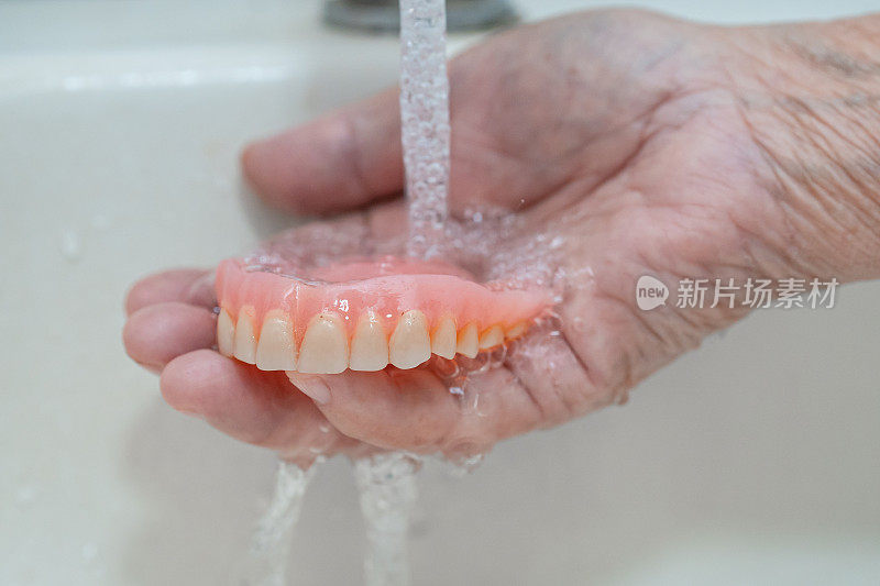 亚洲老年或老年妇女患者持有部分义齿的替代牙齿。