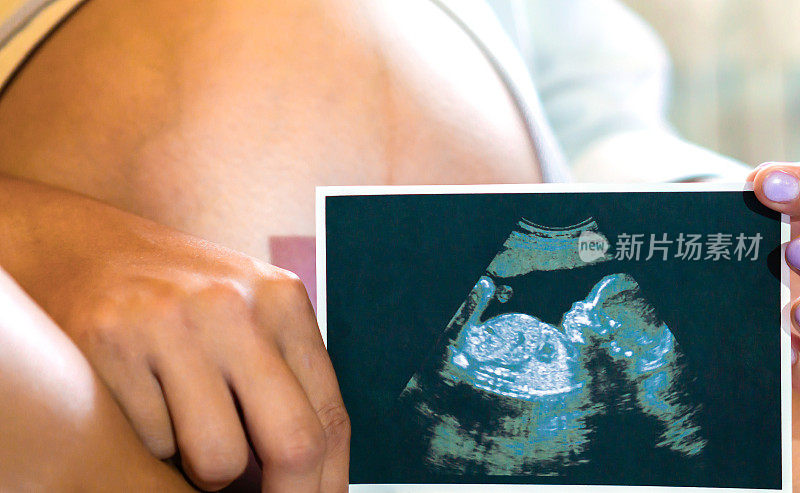 一个怀孕的女孩手里拿着她宝宝的超声波特写照片。怀孕的概念，等待