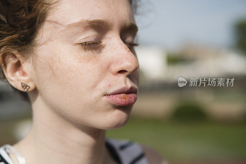 这是一个嘴唇上有疱疹的少女的特写照片