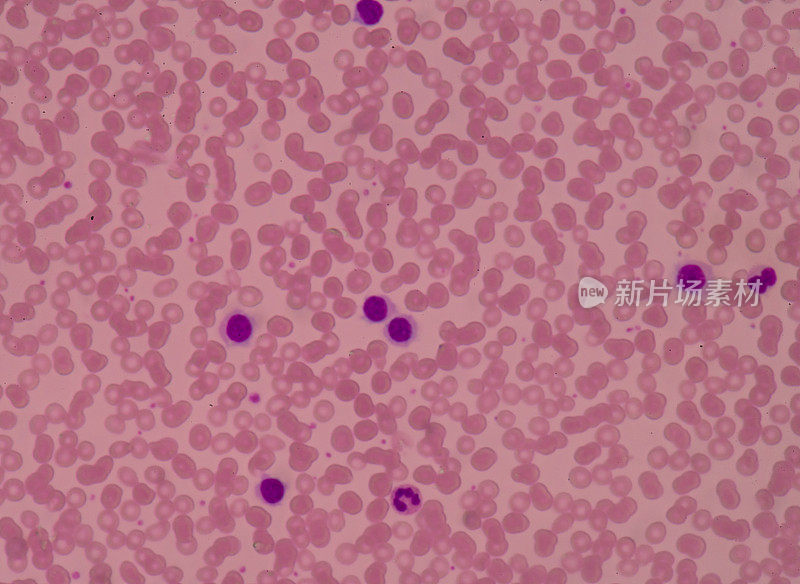 血液涂片显示有红细胞和白细胞医学背景。