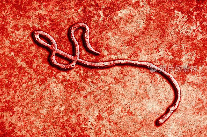 埃博拉病毒(点击查看更多)