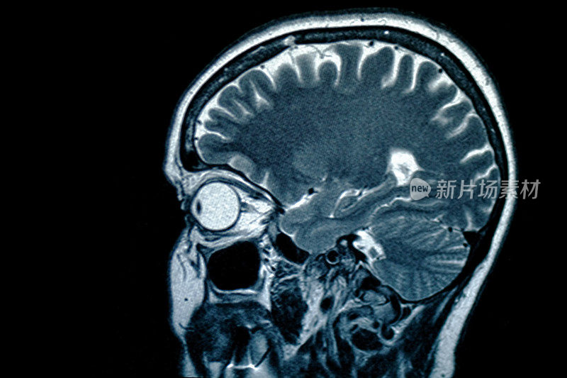 人类头部的x光图像