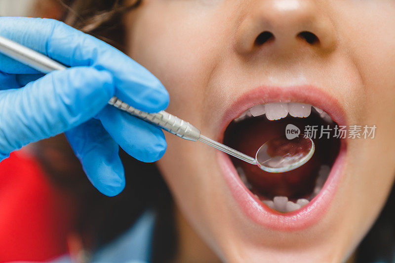 (特写)小孩在牙科诊所检查乳牙时张开的嘴