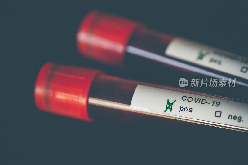 Covid-19试管