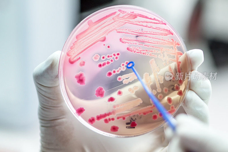 微生物科医院麦康基琼脂上发酵乳糖的粉红色大肠杆菌菌落。
