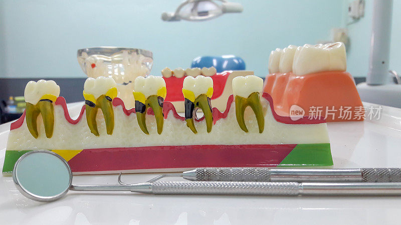牙齿模型和牙科工具