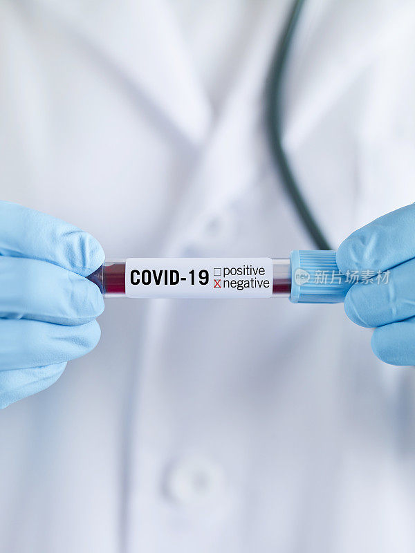 Covid-19阴性血液样本