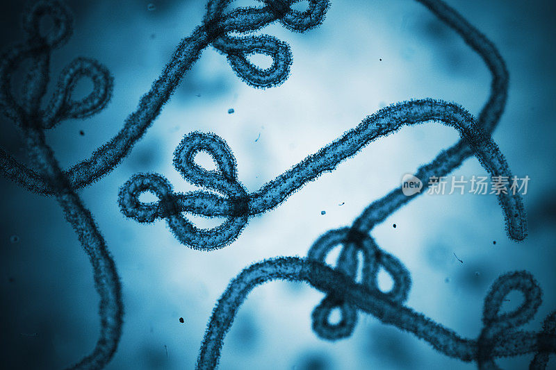 埃博拉病毒。显微镜幻灯片