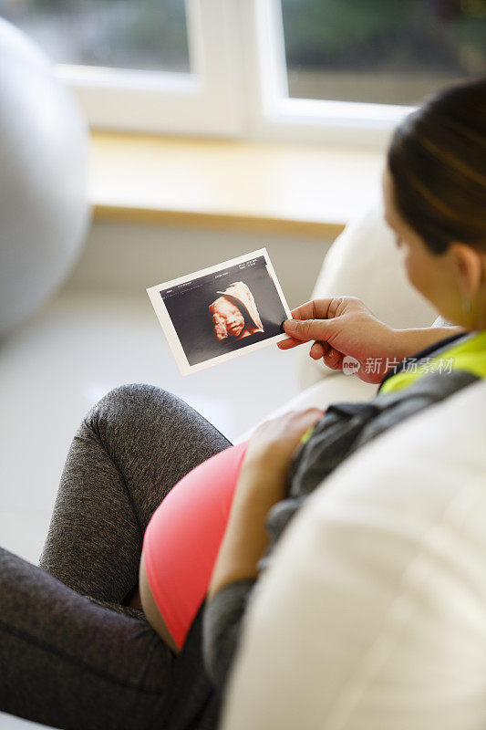 一名孕妇正在看她孩子的超声波照片