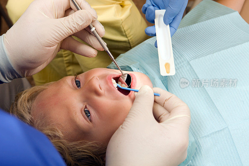 接受牙医氟化物治疗的小男孩