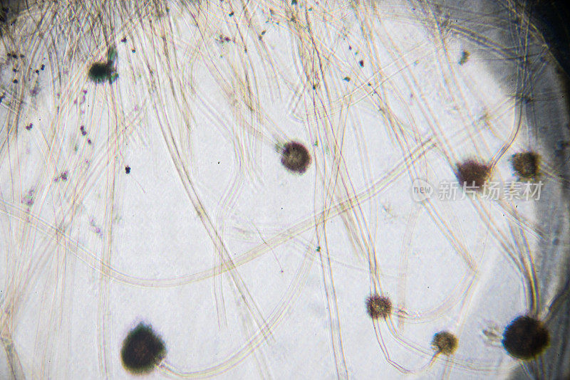 曲霉属真菌在显微镜下