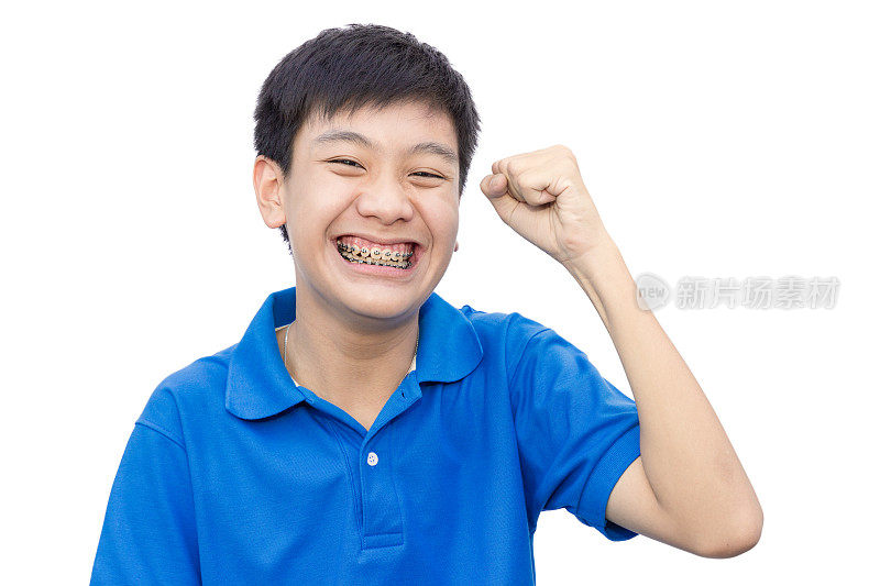 年轻人微笑着用牙齿支撑牙齿在孤立的背景上。