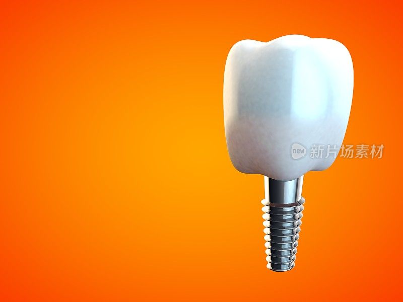 牙磨牙种植牙卫生牙医3D橙色