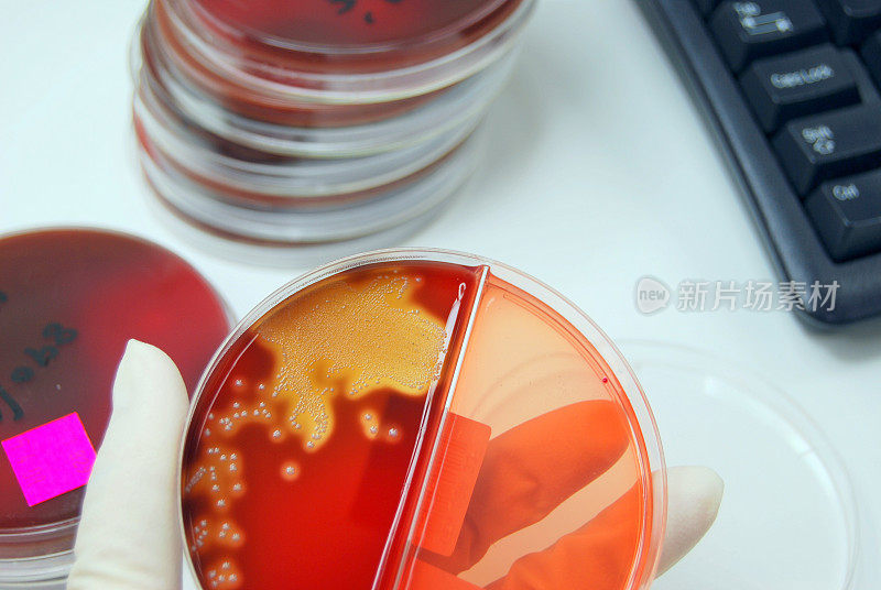 溶血性链球菌的细菌培养