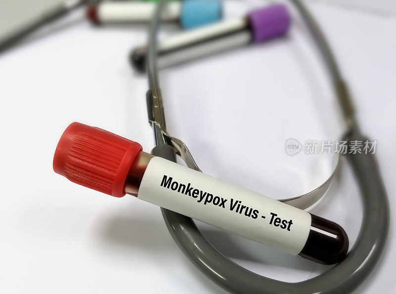 猴痘病毒检测的血液样本。它也被称为Moneypox病毒，一种双链DNA病毒和痘病毒科的成员。
