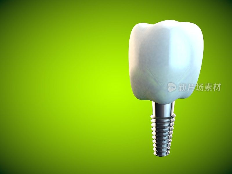 牙齿磨牙种植牙卫生牙医3D绿色