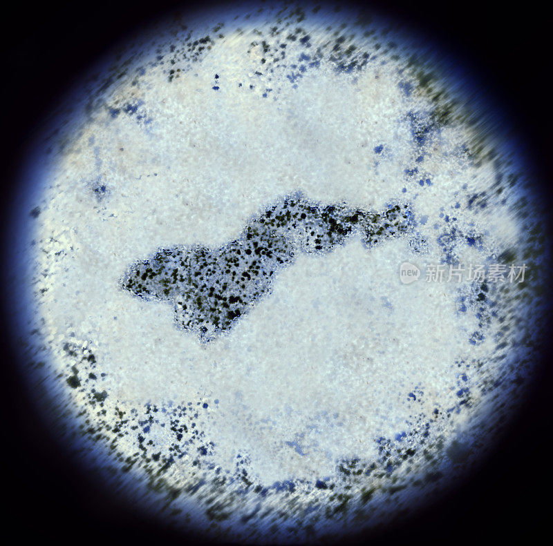 显微镜下的美属萨摩亚形状的细菌(系列)