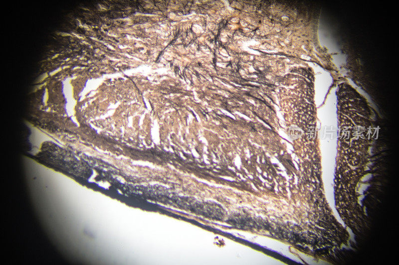 显微镜下脊髓横切面