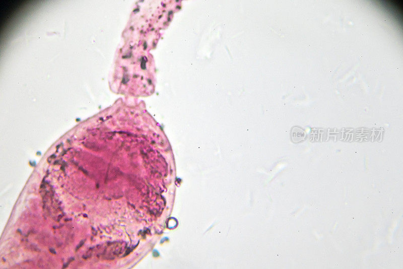 日本血吸虫尾蚴光镜下观察