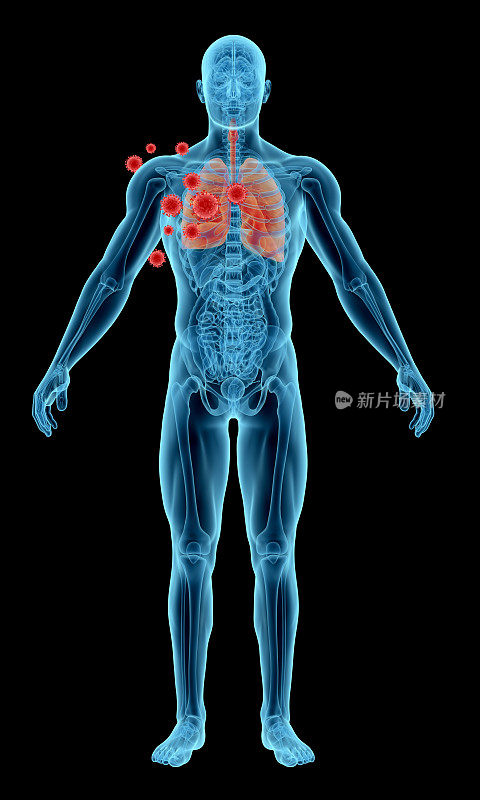 肺病毒感染