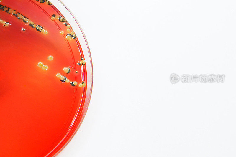 微生物学:细菌培养物