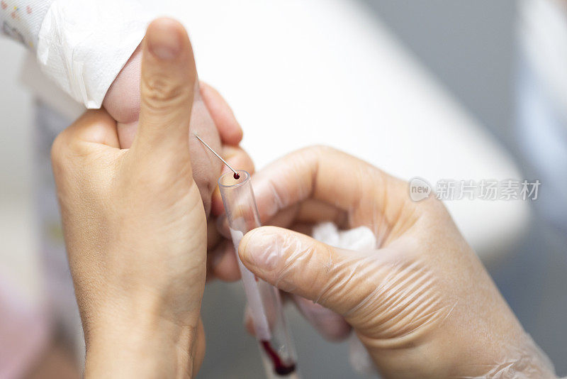婴儿血液测试