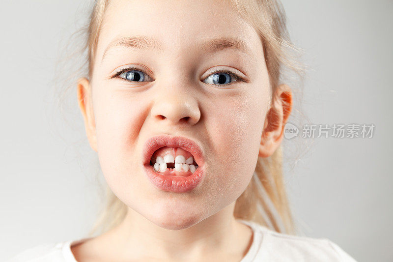 第一个孩子的牙齿掉了下来。一个牙齿上有个洞的小女孩的肖像