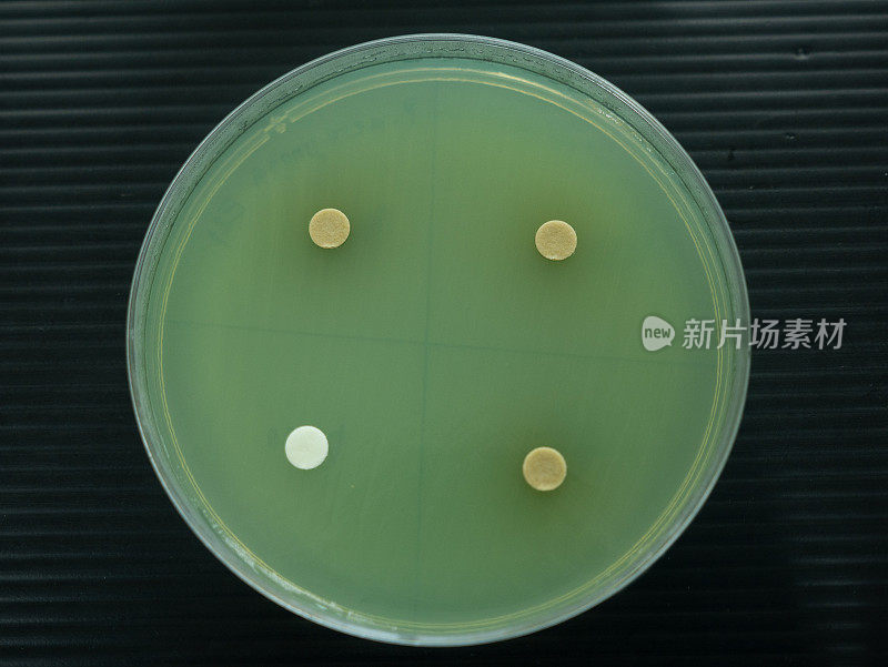在实验室检查抗生素的培养皿的特写镜头。
