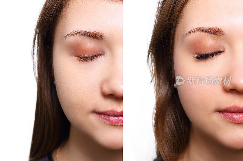 睫毛扩展。女性眼睛前后对比