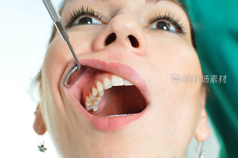 口腔检查-牙科医生检查病人的口腔和牙齿