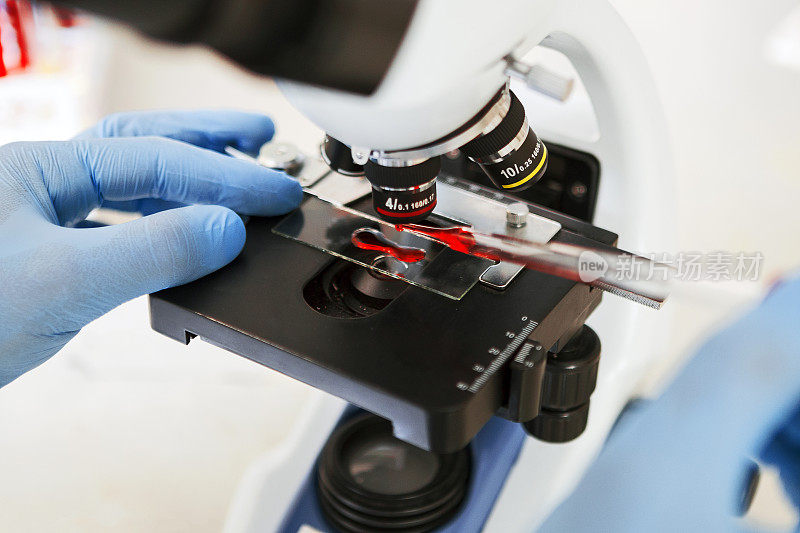 实验室技术员在显微镜下观察血液样本