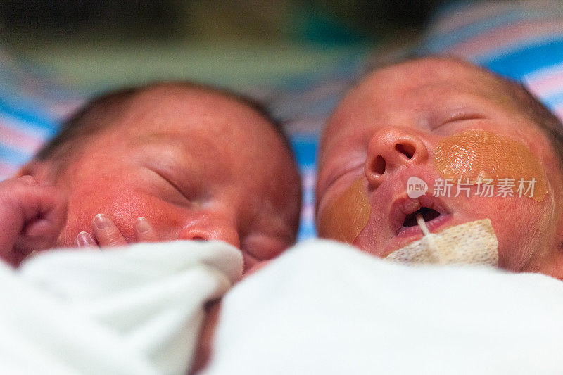 同卵双胞胎男孩在新生儿重症监护室